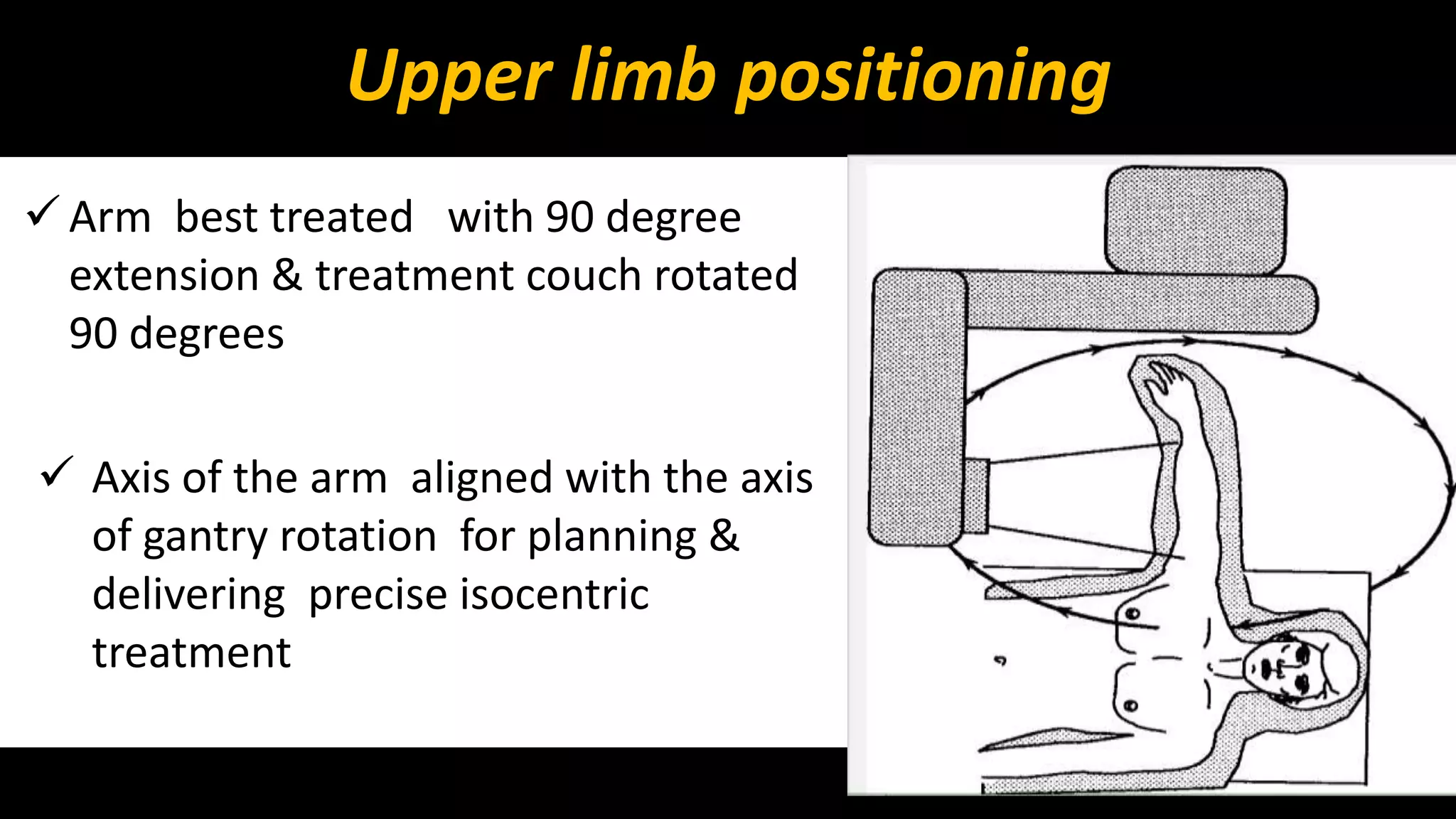 Upper limb positioning 
 Arm best treated with 90 degree 
extension & treatment couch rotated 
90 degrees 
 Axis of the arm aligned with the axis 
of gantry rotation for planning & 
delivering precise isocentric 
treatment 
 