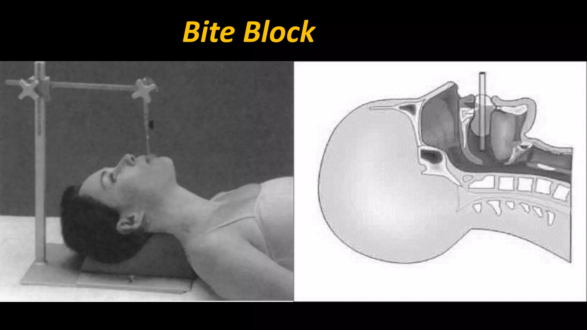 Bite Block 
 