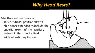 Why Head Rests? 
Maxillary antrum tumors- 
-patient's head positioned with 
chin hyper extended to include the 
superior extent of the maxillary 
antrum in the anterior field 
without including the eye. 
 