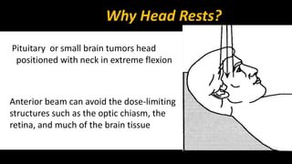 Why Head Rests? 
Pituitary or small brain tumors head 
positioned with neck in extreme flexion 
Anterior beam can avoid the dose-limiting 
structures such as the optic chiasm, the 
retina, and much of the brain tissue 
 