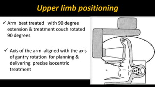 Upper limb positioning 
 Arm best treated with 90 degree 
extension & treatment couch rotated 
90 degrees 
 Axis of the arm aligned with the axis 
of gantry rotation for planning & 
delivering precise isocentric 
treatment 
 