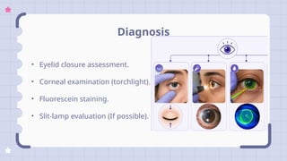 Preventing Exposure Keratitis in ICU Patients: A Critical Eye Care ...
