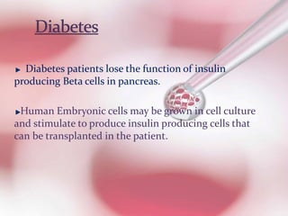 Diabetes patients lose the function of insulin
producing Beta cells in pancreas.
Human Embryonic cells may be grown in cell culture
and stimulate to produce insulin producing cells that
can be transplanted in the patient.
 