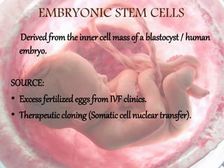 EMBRYONIC STEM CELLS
Derivedfromthe inner cell mass of a blastocyst / human
embryo.
SOURCE:
• Excess fertilizedeggs fromIVF clinics.
• Therapeutic cloning (Somaticcell nuclear transfer).
 