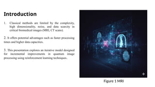 Design of an Iterative Model for Incremental Enhancements in Quantum ...