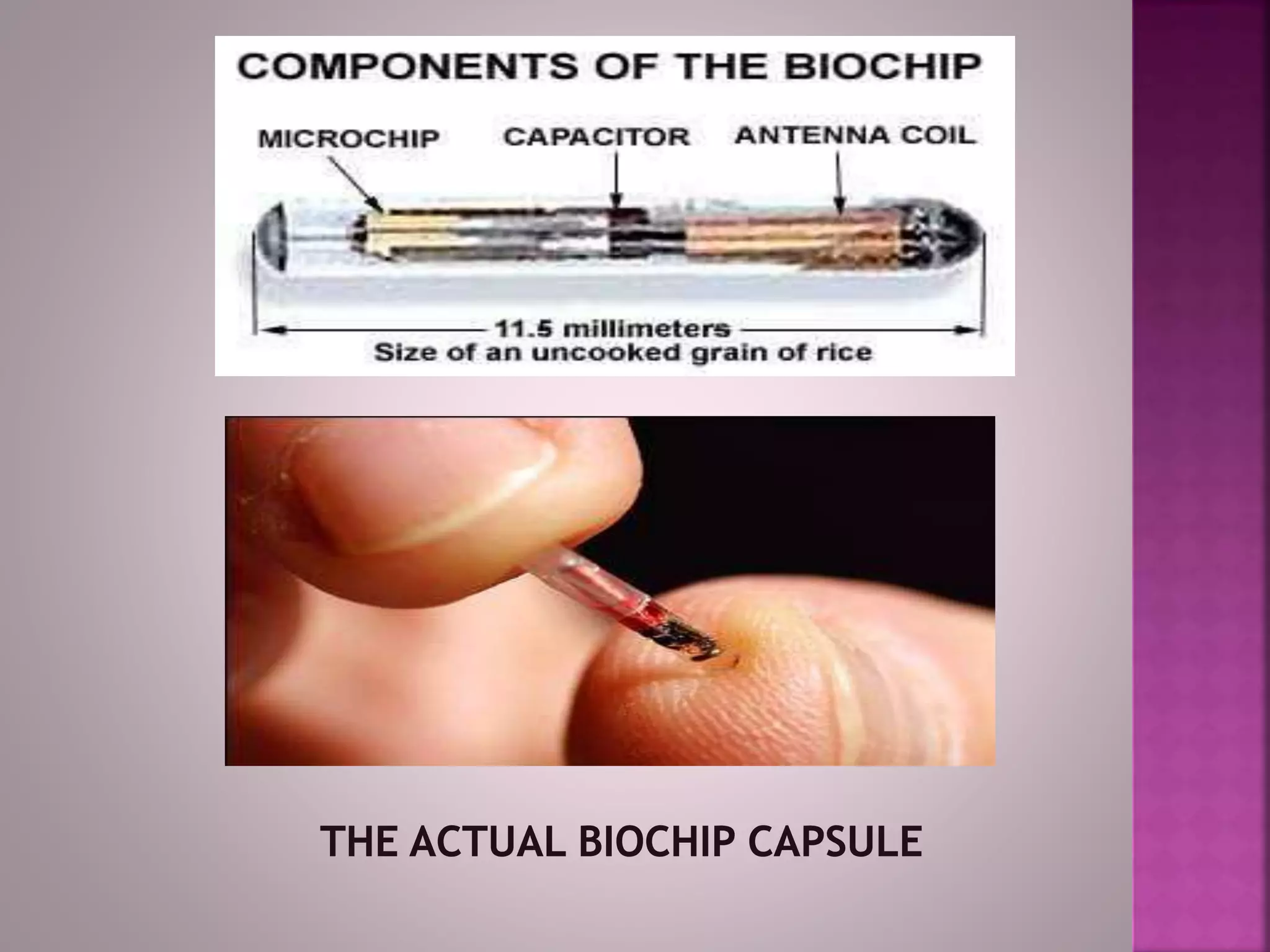 biochip by diksha kumari 3rd year iilm | PPTX