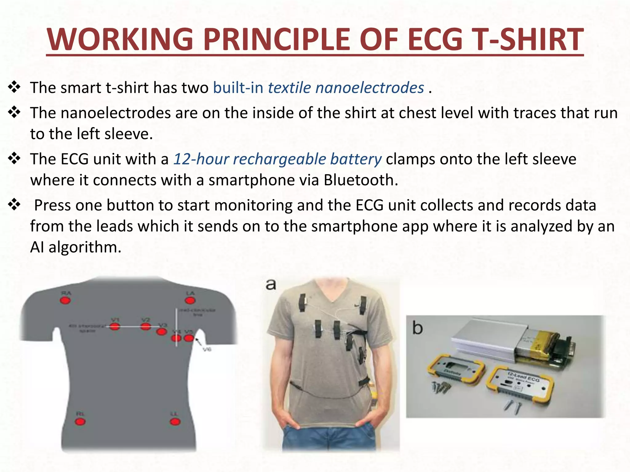 WORKING PRINCIPLE OF ECG T-SHIRT
 The smart t-shirt has two built-in textile nanoelectrodes .
 The nanoelectrodes are on the inside of the shirt at chest level with traces that run
to the left sleeve.
 The ECG unit with a 12-hour rechargeable battery clamps onto the left sleeve
where it connects with a smartphone via Bluetooth.
 Press one button to start monitoring and the ECG unit collects and records data
from the leads which it sends on to the smartphone app where it is analyzed by an
AI algorithm.
 