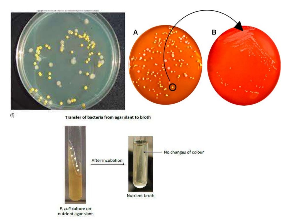 Microbial Culture Preservation and its Methods