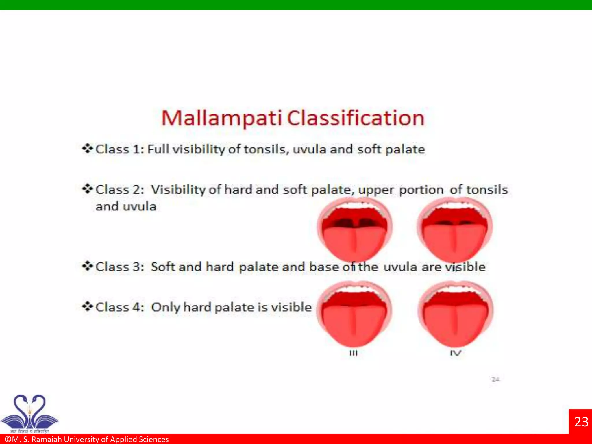 ©M. S. Ramaiah University of Applied Sciences
23
 