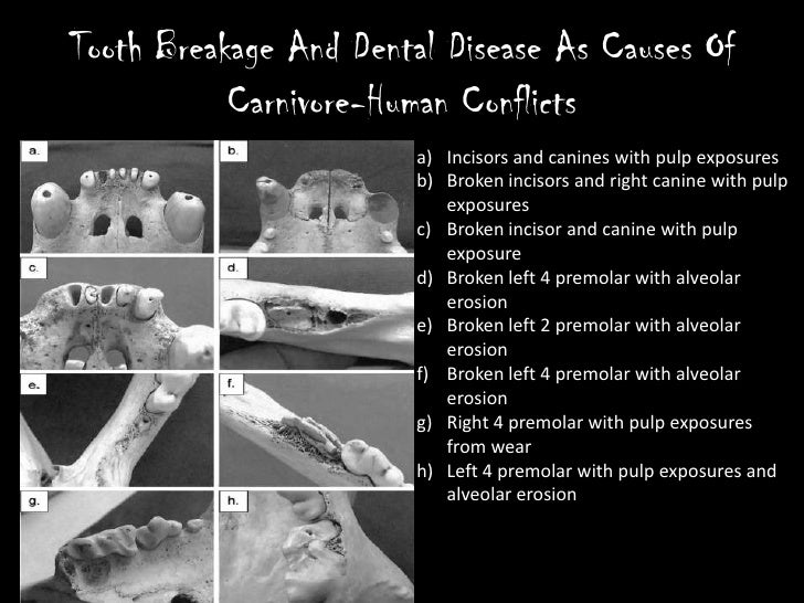 Tooth Breakage And Dental Disease As Causes Of CarnivoreHuman Confli…