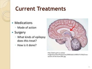 Current Treatments

   Medications
    ◦ Mode of action
   Surgery
    ◦ What kinds of epilepsy
      does this treat?
    ◦ How is it done?

                               http://static.guim.co.uk/sys-
                               images/Guardian/Pix/pictures/2009/4/6/1239055717363/Cross-
                               section-of-the-huma-001.jpg




                                                                                            10
 