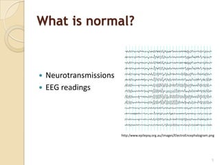 What is normal?



 Neurotransmissions
 EEG readings




                       http:/www.epilepsy.org.au/images/ElectroEncephalogram.png




                                                                              5
 