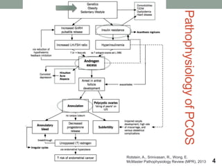 PathophysiologyofPCOS
4
Rotstein, A., Srinivasan, R., Wong, E.
McMaster Pathophysiology Review (MPR), 2013
 