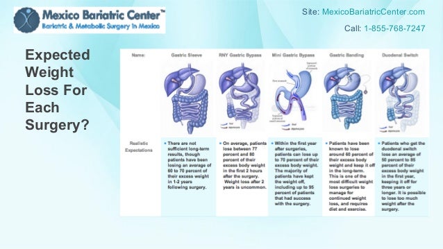 Canadian Obesity Bariatric Surgery Presentation