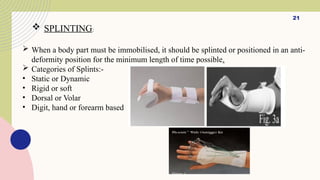 Digit Plints seminar presentation.pptx upload powerpoint presentation | PPTX