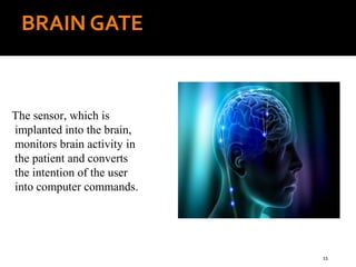 brain chip technology | PPT