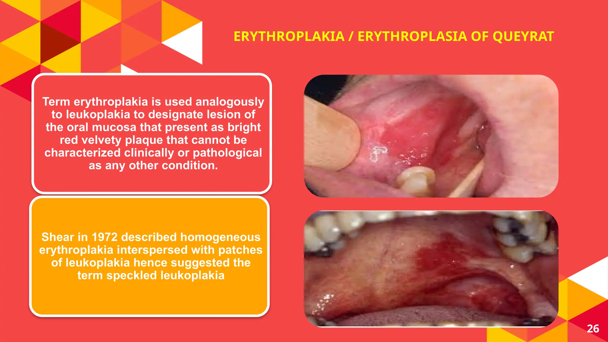 ORAL POTENTIALLY MALIGNANT DISORDERS (OPMD) | PPTX
