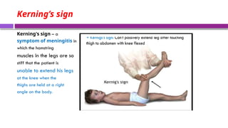 Seminar_presentation_on_Management_of_Meningitis_in_pediatrics.pptx