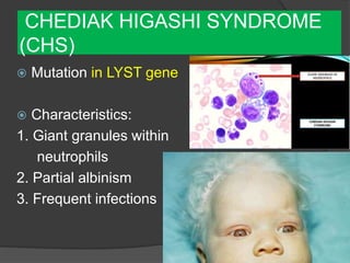 CHEDIAK HIGASHI SYNDROME
(CHS)
 Mutation in LYST gene
 Characteristics:
1. Giant granules within
neutrophils
2. Partial albinism
3. Frequent infections
 