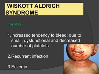 WISKOTT ALDRICH
SYNDROME
TRIAD :
1.Increased tendency to bleed: due to
small, dysfunctional and decreased
number of platelets
2.Recurrent infection
3.Eczema
 