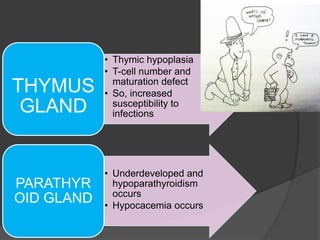• Thymic hypoplasia
• T-cell number and
maturation defect
• So, increased
susceptibility to
infections
THYMUS
GLAND
• Underdeveloped and
hypoparathyroidism
occurs
• Hypocacemia occurs
PARATHYR
OID GLAND
 