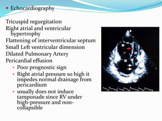  Echocardiography
Tricuspid regurgitation
Right atrial and ventricular
hypertrophy
Flattening of interventricular septum
Small Left ventricular dimension
Dilated Pulmonary Artery
Pericardial effusion
• Poor prognostic sign
• Right atrial pressure so high it
impedes normal drainage from
pericardium
• usually does not induce
tamponade since RV under
high-pressure and non-
collapsible
 