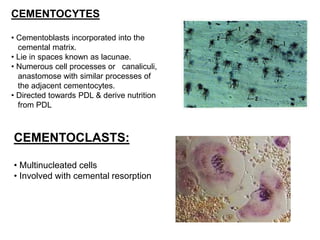 CEMENTOCYTES
• Cementoblasts incorporated into the
cemental matrix.
• Lie in spaces known as lacunae.
• Numerous cell processes or canaliculi,
anastomose with similar processes of
the adjacent cementocytes.
• Directed towards PDL & derive nutrition
from PDL
CEMENTOCLASTS:
• Multinucleated cells
• Involved with cemental resorption
 