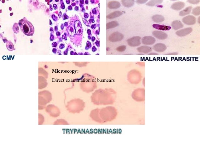test anca blood p unknown pyrexia origin(puo). of test anca blood p unknown pyrexia origin(puo). of