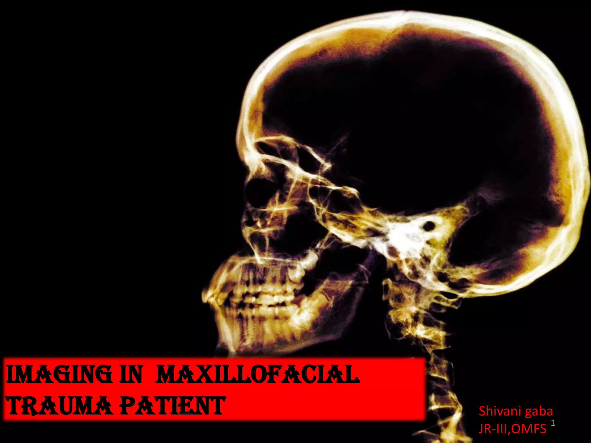 conventional radiography in maxillofacial trauma | PPTX