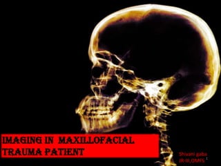 Imaging in maxillofacial
trauma patient Shivani gaba
JR-III,OMFS
1
 
