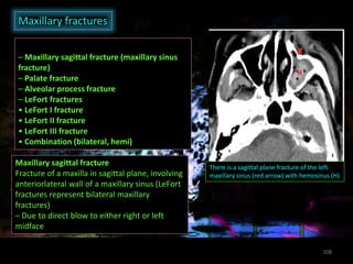 conventional radiography in maxillofacial trauma