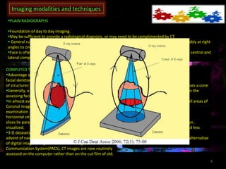 conventional radiography in maxillofacial trauma | PPTX