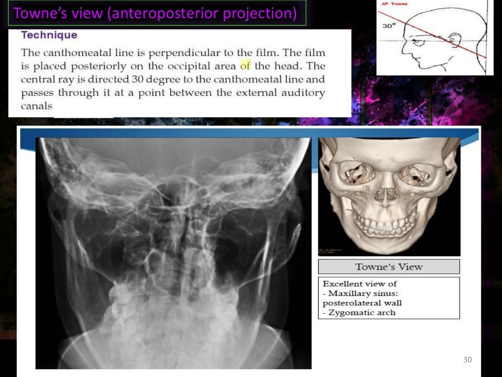 conventional radiography in maxillofacial trauma
