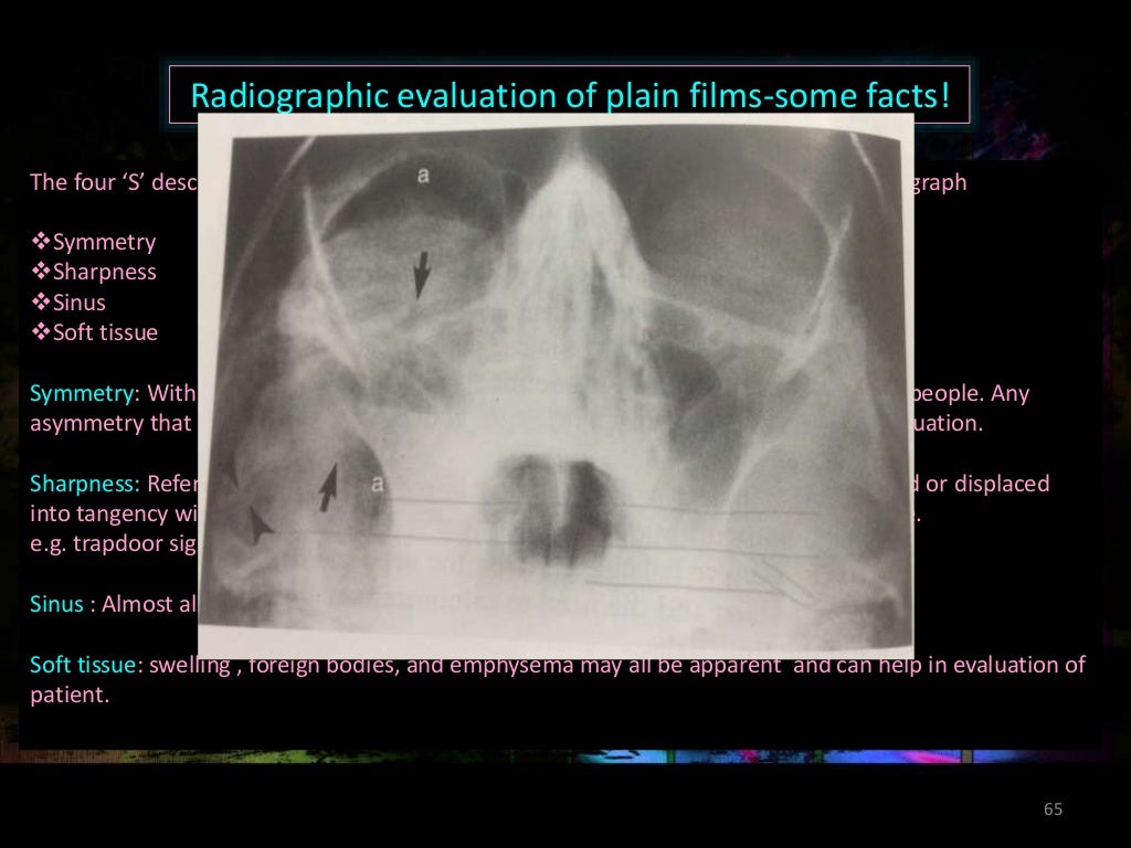 conventional radiography in maxillofacial trauma