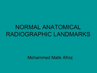 NORMAL ANATOMICAL
RADIOGRAPHIC LANDMARKS
Mohammed Malik Afroz
 