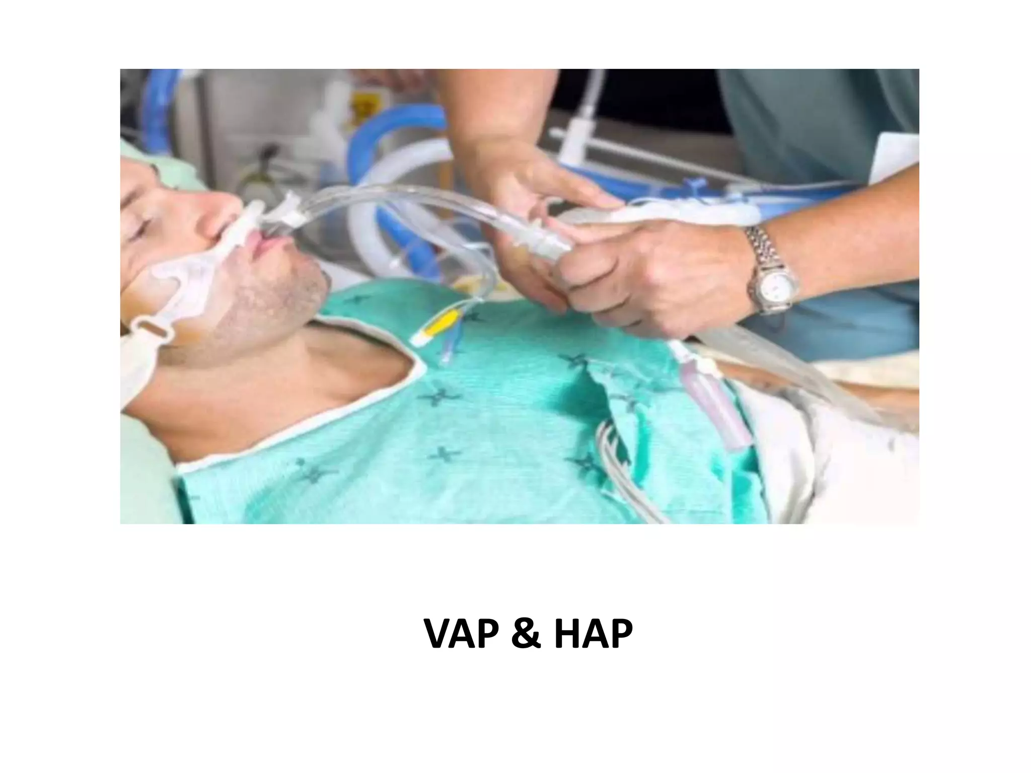 VAP & HAP
 