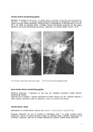 Seminarski vratna-kicma | DOCX