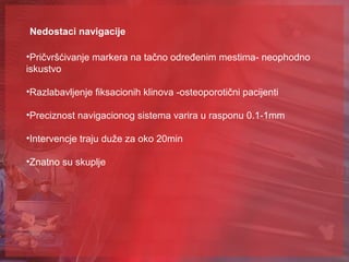 Navigacioni sistemi u ortopediji | PPT