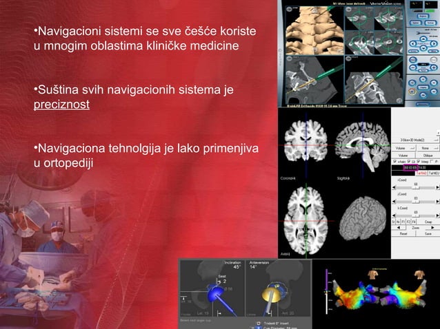 Navigacioni sistemi u ortopediji | PPT