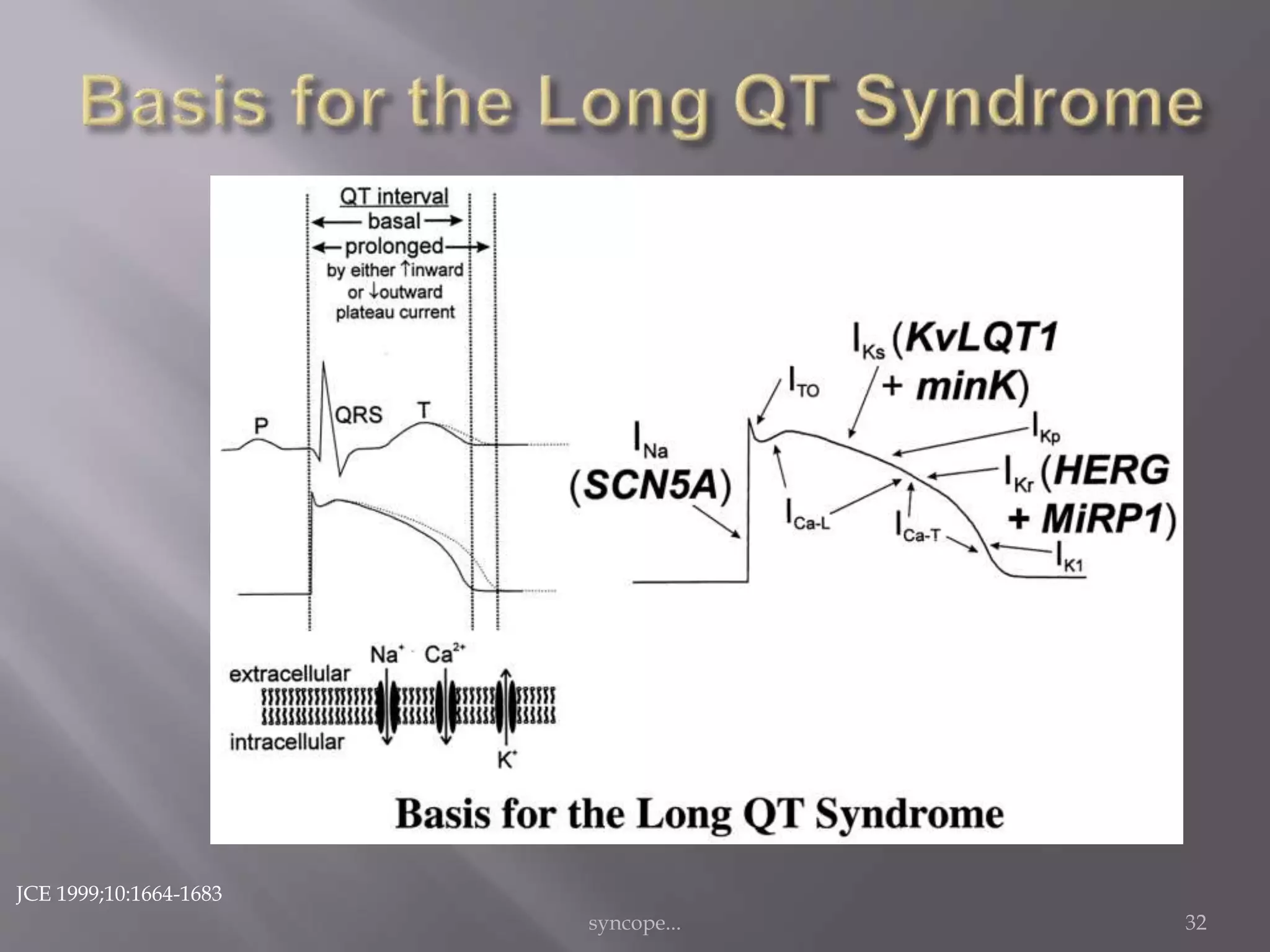 syncope... 32
JCE 1999;10:1664-1683
 