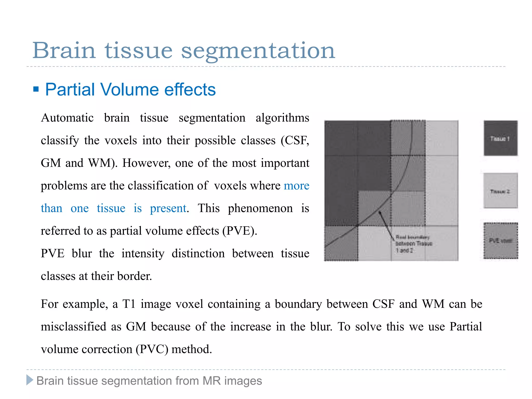Brain tissue segmentation from MR images | PPT