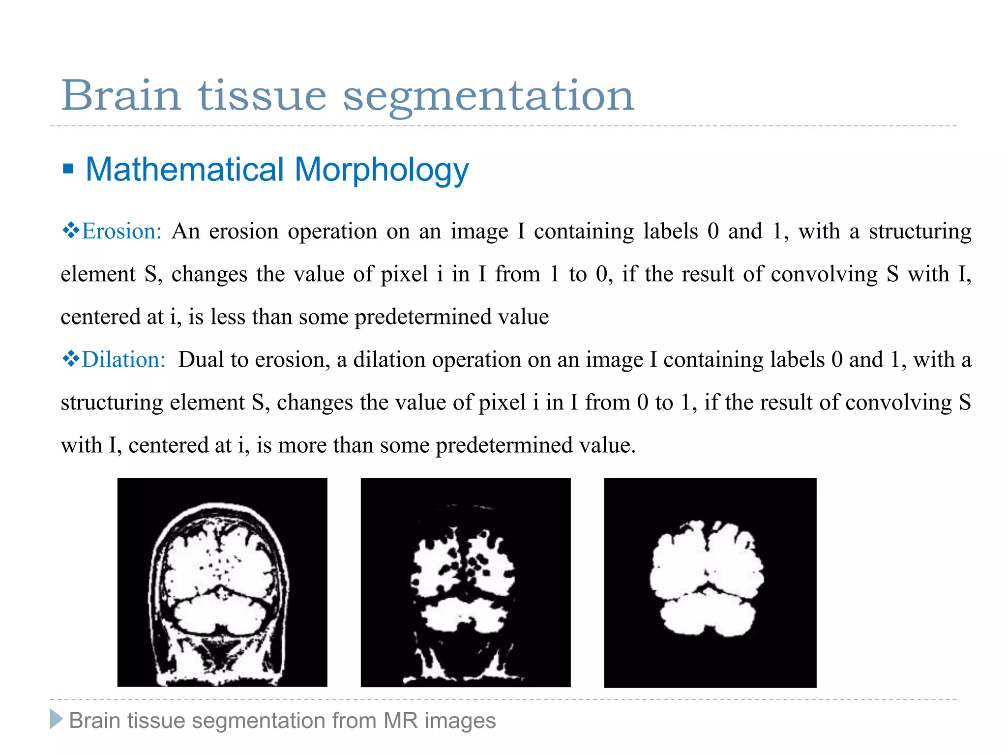 Brain tissue segmentation
 Mathematical Morphology
Erosion: An erosion operation on an image I containing labels 0 and 1, with a structuring
element S, changes the value of pixel i in I from 1 to 0, if the result of convolving S with I,
centered at i, is less than some predetermined value
Dilation: Dual to erosion, a dilation operation on an image I containing labels 0 and 1, with a
structuring element S, changes the value of pixel i in I from 0 to 1, if the result of convolving S
with I, centered at i, is more than some predetermined value.
Brain tissue segmentation from MR images
 