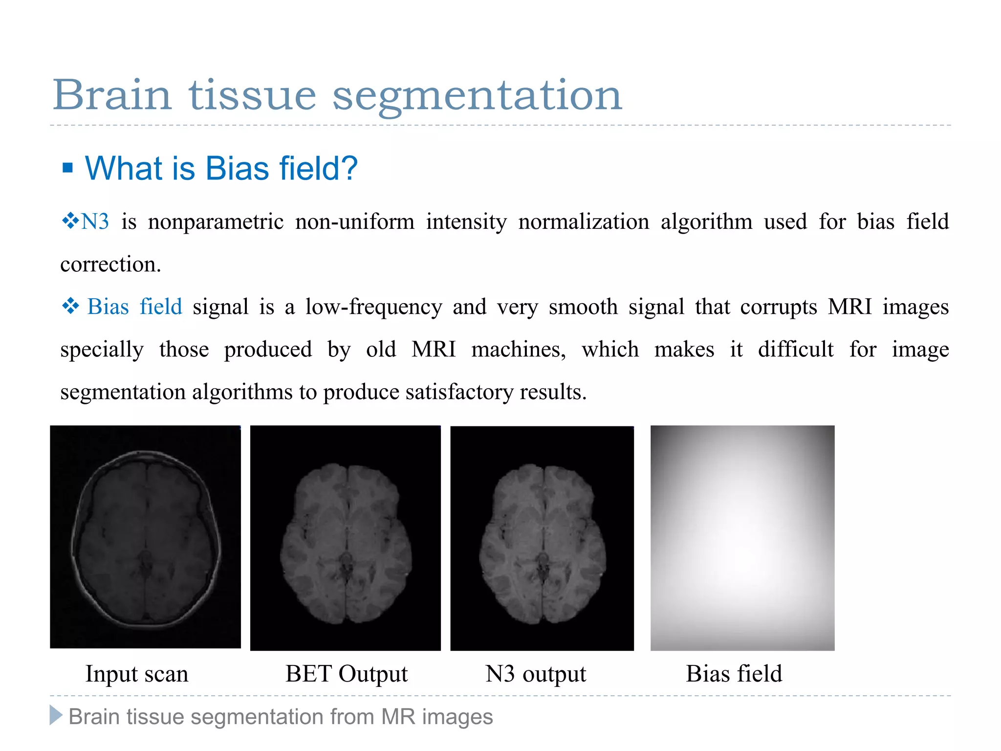 N3 is nonparametric non-uniform intensity normalization algorithm used for bias field
correction.
 Bias field signal is a low-frequency and very smooth signal that corrupts MRI images
specially those produced by old MRI machines, which makes it difficult for image
segmentation algorithms to produce satisfactory results.
 What is Bias field?
Input scan BET Output N3 output Bias field
Brain tissue segmentation
Brain tissue segmentation from MR images
 