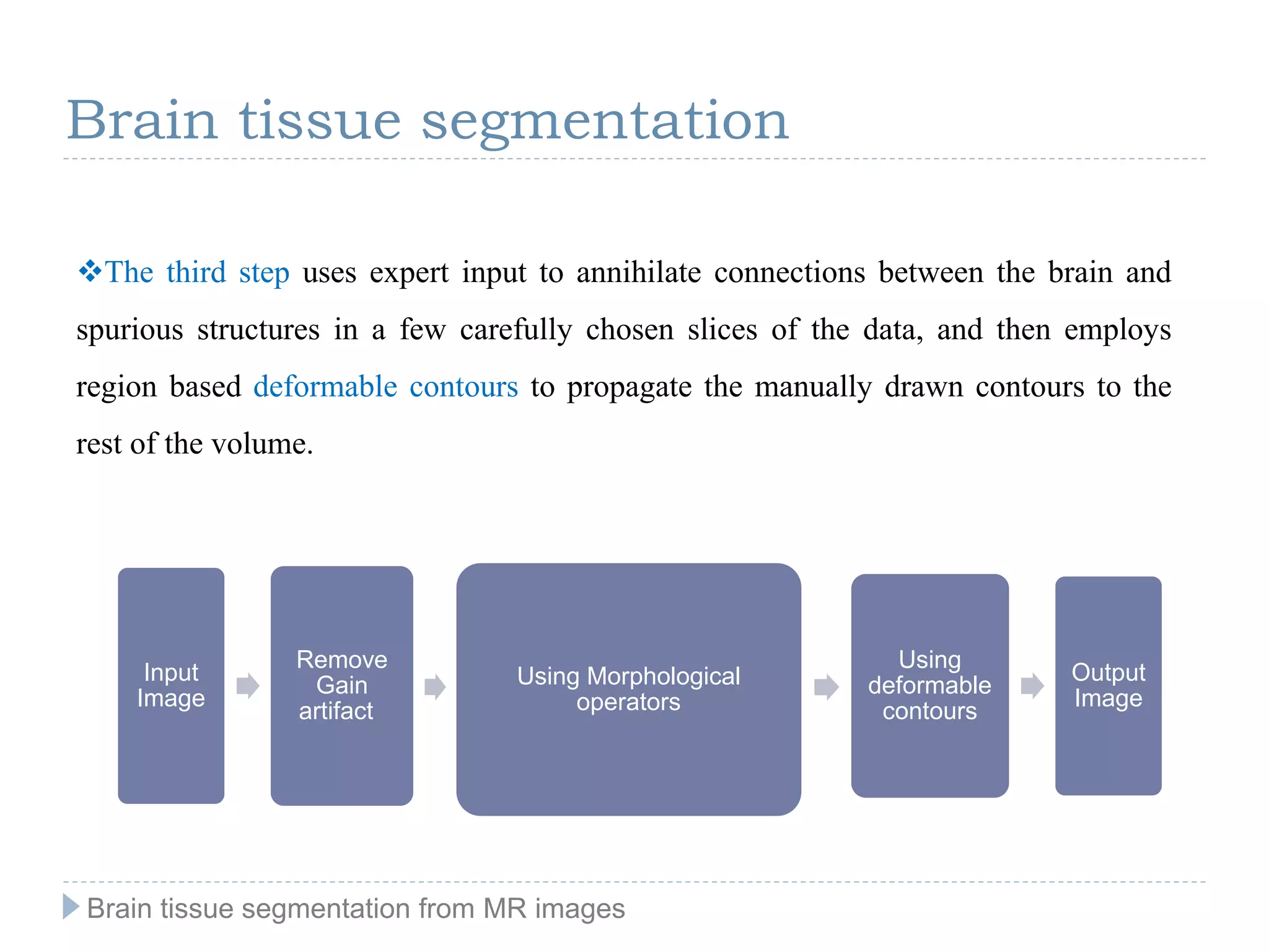Brain tissue segmentation from MR images | PPT