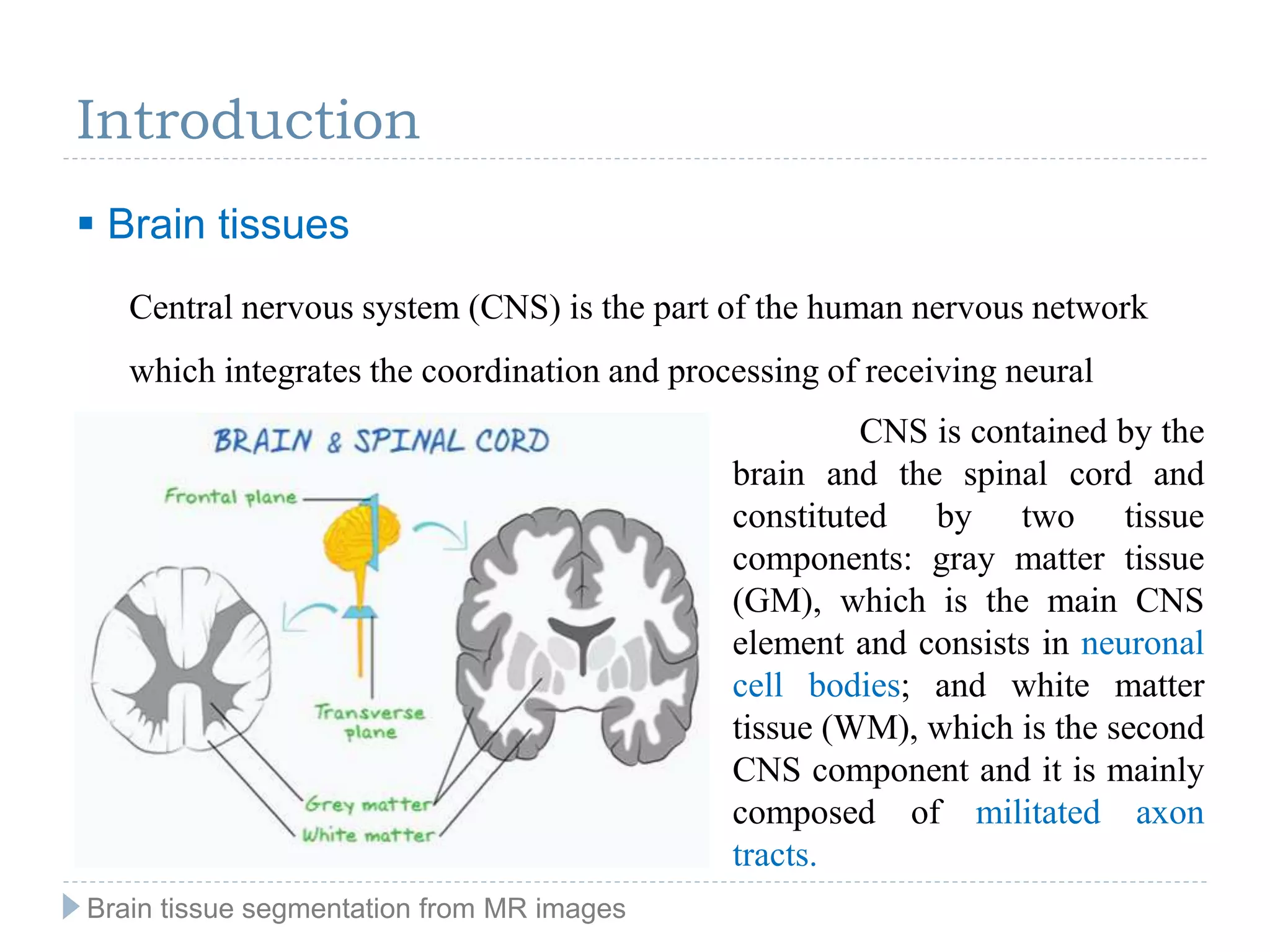  Brain tissues
Introduction
Central nervous system (CNS) is the part of the human nervous network
which integrates the coordination and processing of receiving neural
information. CNS is contained by the
brain and the spinal cord and
constituted by two tissue
components: gray matter tissue
(GM), which is the main CNS
element and consists in neuronal
cell bodies; and white matter
tissue (WM), which is the second
CNS component and it is mainly
composed of militated axon
tracts.
Brain tissue segmentation from MR images
 