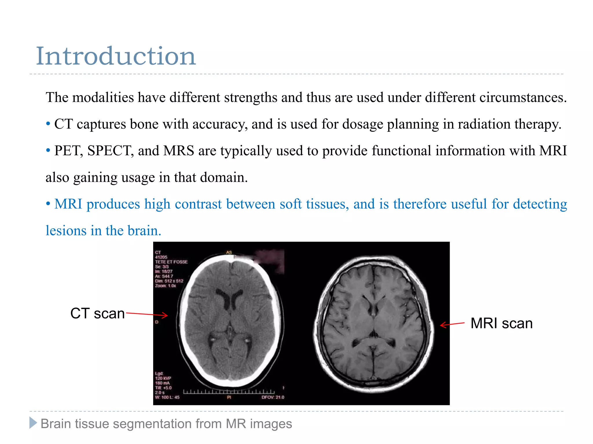 Brain tissue segmentation from MR images | PPT