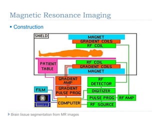  Construction
Magnetic Resonance Imaging
Brain tissue segmentation from MR images
 