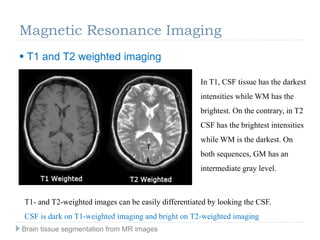 Magnetic Resonance Imaging
 T1 and T2 weighted imaging
T1- and T2-weighted images can be easily differentiated by looking the CSF.
CSF is dark on T1-weighted imaging and bright on T2-weighted imaging
In T1, CSF tissue has the darkest
intensities while WM has the
brightest. On the contrary, in T2
CSF has the brightest intensities
while WM is the darkest. On
both sequences, GM has an
intermediate gray level.
Brain tissue segmentation from MR images
 