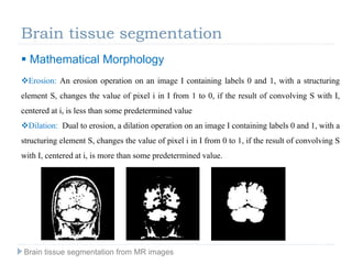 Brain tissue segmentation
 Mathematical Morphology
Erosion: An erosion operation on an image I containing labels 0 and 1, with a structuring
element S, changes the value of pixel i in I from 1 to 0, if the result of convolving S with I,
centered at i, is less than some predetermined value
Dilation: Dual to erosion, a dilation operation on an image I containing labels 0 and 1, with a
structuring element S, changes the value of pixel i in I from 0 to 1, if the result of convolving S
with I, centered at i, is more than some predetermined value.
Brain tissue segmentation from MR images
 