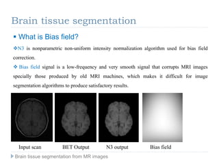 N3 is nonparametric non-uniform intensity normalization algorithm used for bias field
correction.
 Bias field signal is a low-frequency and very smooth signal that corrupts MRI images
specially those produced by old MRI machines, which makes it difficult for image
segmentation algorithms to produce satisfactory results.
 What is Bias field?
Input scan BET Output N3 output Bias field
Brain tissue segmentation
Brain tissue segmentation from MR images
 